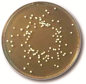 Escherichia coli ATCC 25922. 